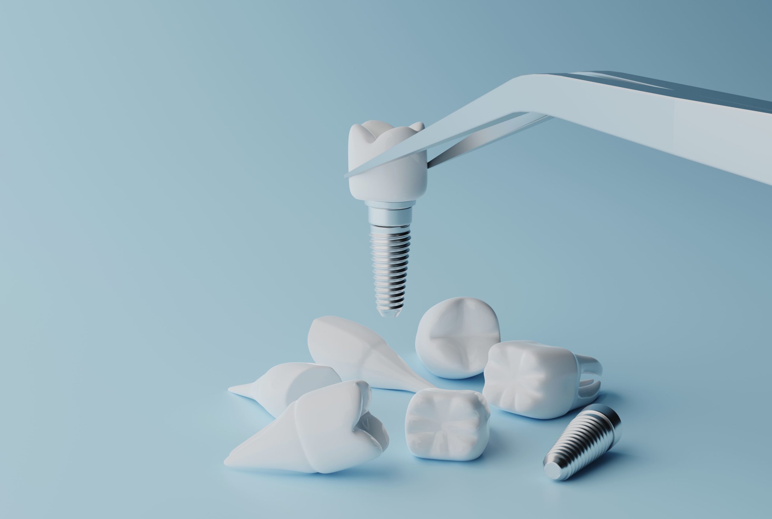 concept implant dentar timisoara instrumente profesionale clinica dentala ismiledental timisoara