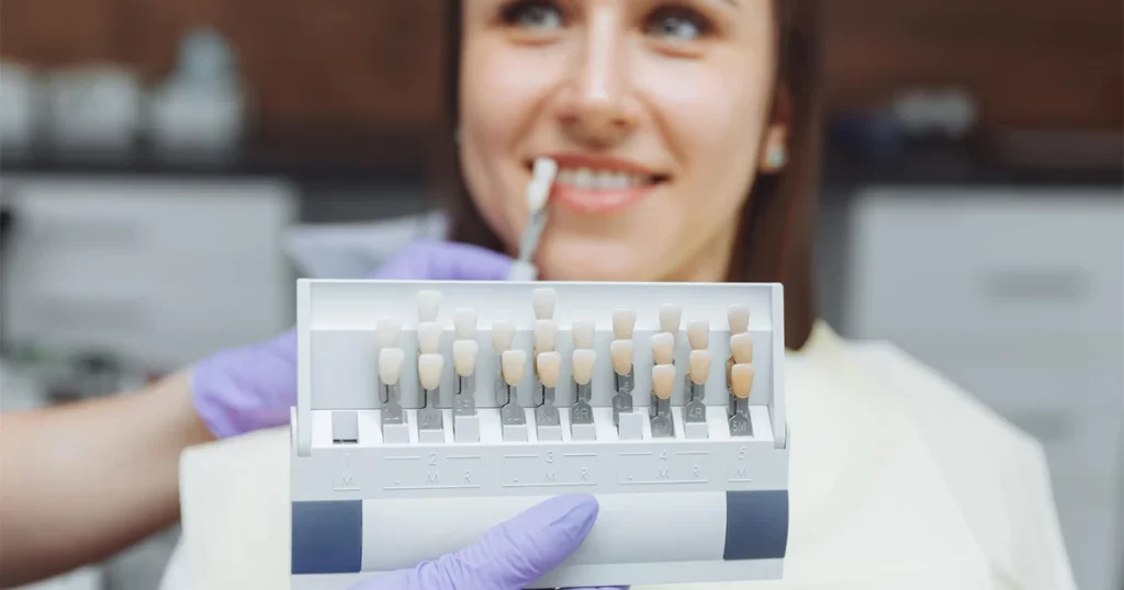 Fațete dentare: 5 cele mai comune întrebări și răspunsuri